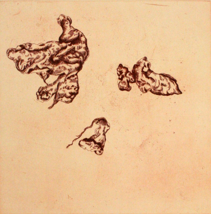 Chocolate Cysts of The Ovary III